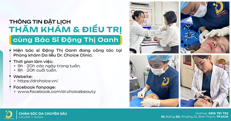 Trị tàn nhang bs Đặng Thị Oanh