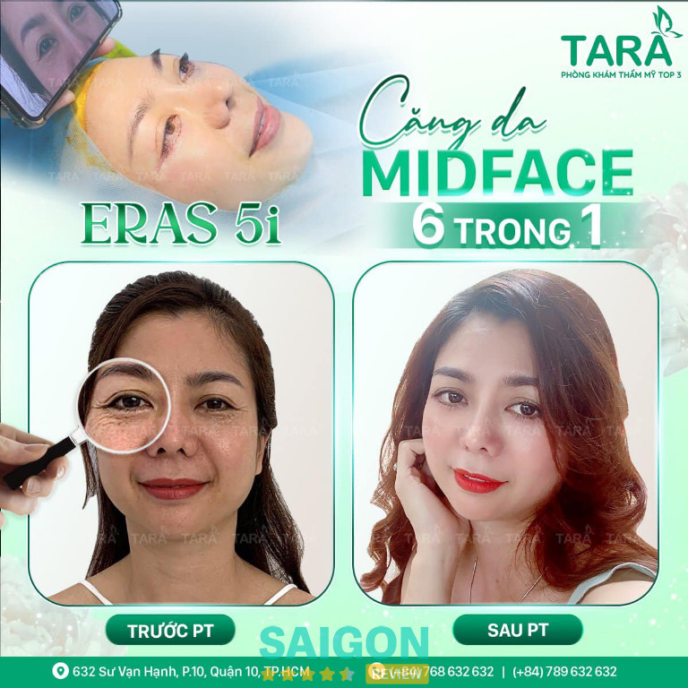 Tara Beauty Clinic tại TPHCM