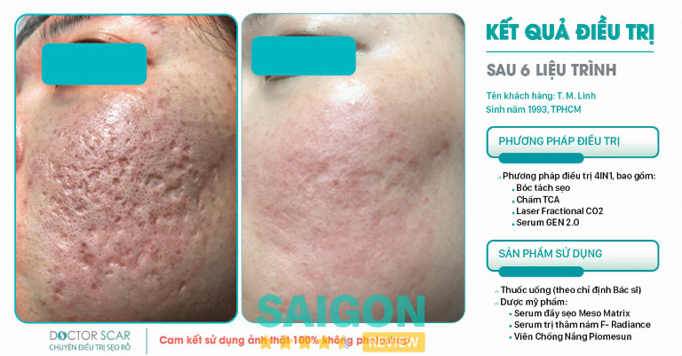 Phòng khám Da liễu Doctor Scar TPHCM