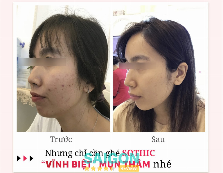 Thẩm Mỹ Viện Sothic