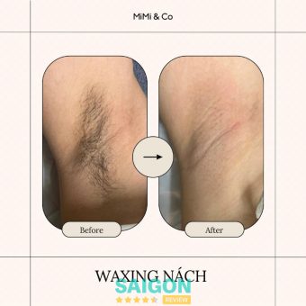 Spa chuyên wax lông tại Quận 3 chất lượng