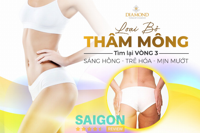 Thẩm mỹ Diamond