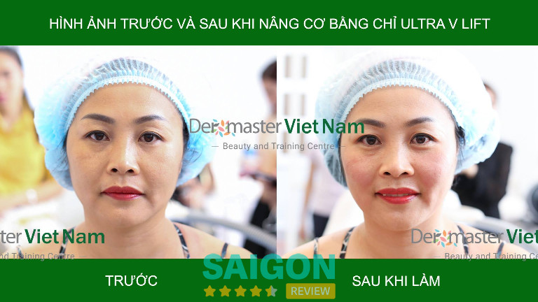 Dermaster Việt Nam