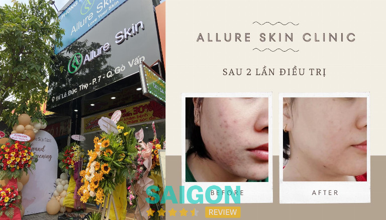 Phòng khám da liễu Allure Skin Clinic