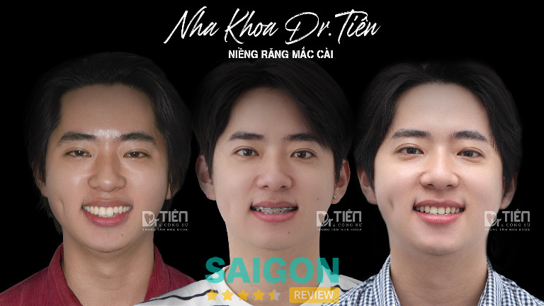 Nha Khoa Dr Tiên tại Quận 9, TPHCM