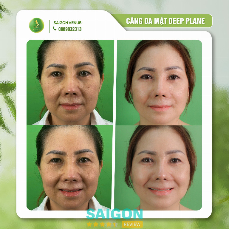 Sài Gòn Venus & Bác sĩ Nguyễn Tiến Huy