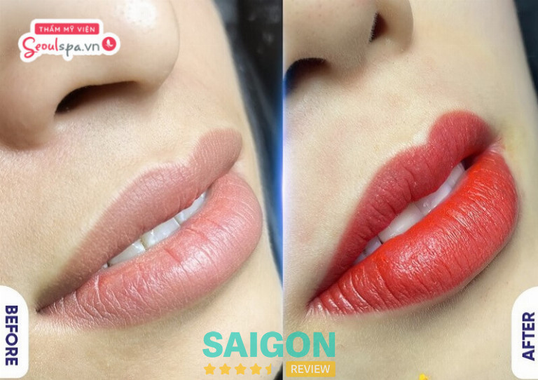 Thẩm Mỹ Viện Seoul Spa – 180A1 Nguyễn Văn Thủ