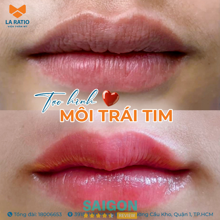 Viện Thẩm Mỹ La Ratio – 182 Điện Biên Phủ