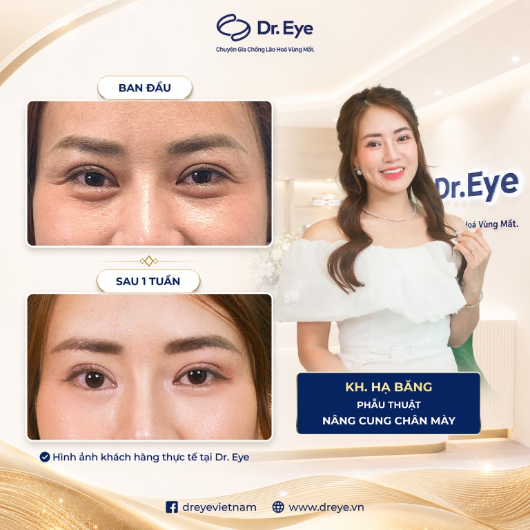 Phòng khám Chuyên khoa Thẩm mỹ Dr. Eye tại TPHCM Phòng khám Chuyên khoa Thẩm mỹ Dr. Eye tại TPHCM