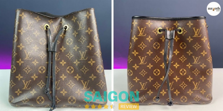 Trước và sau khi sửa túi ở mr anth