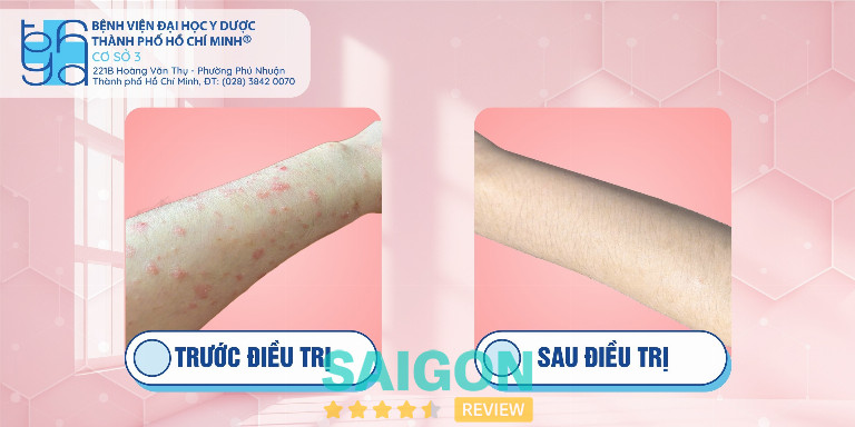Bệnh viện Đại học Y Dược TPHCM - P. Chợ Lớn