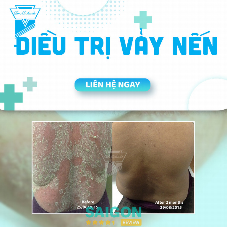 Phòng khám Da liễu Dr Michaels – TP. Thủ Đức 