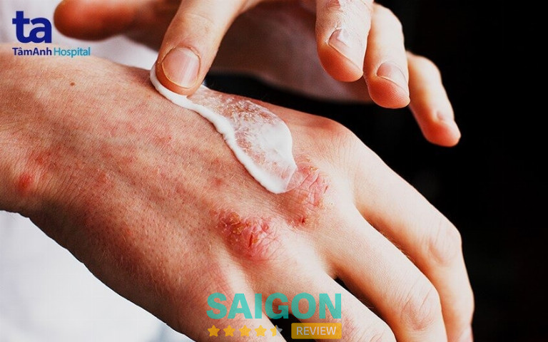 Bệnh viện Tâm Anh - P. Tân Sơn Hòa
