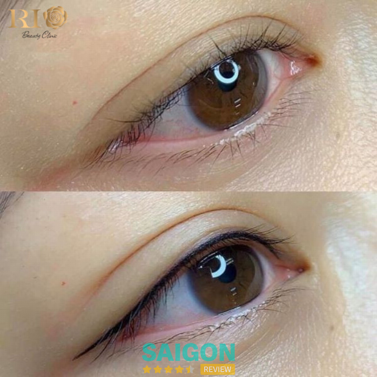 phun mí mắt tại Rio