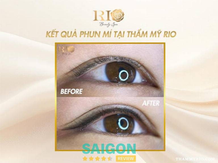 phun mí mắt tại Thẩm Mỹ Rio 