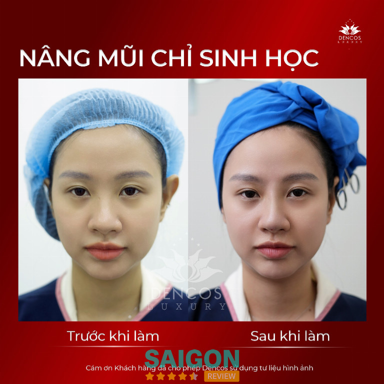 Viện Thẩm Mỹ Quốc Tế Dencos Luxury - 227A Lê Hồng Phong