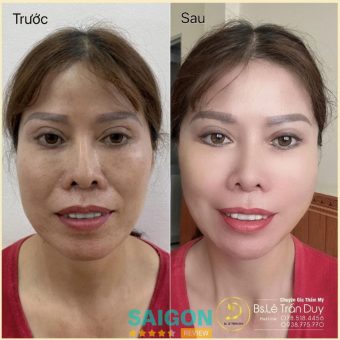 Thẩm Mỹ Galaxy – Bác sĩ Lê Trần Duy - Quận 6