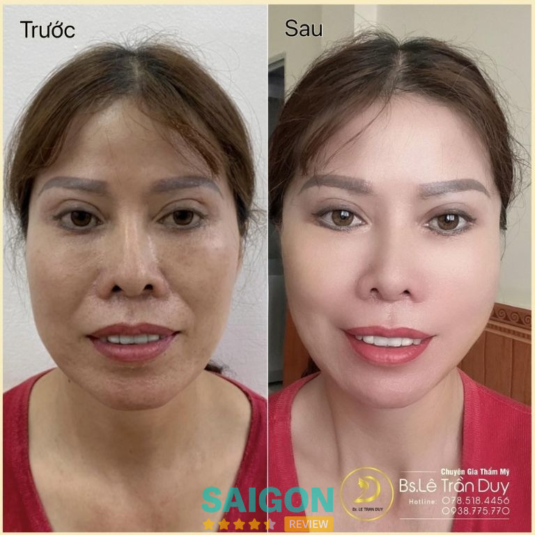 Thẩm Mỹ Galaxy – Bác sĩ Lê Trần Duy - Quận 6