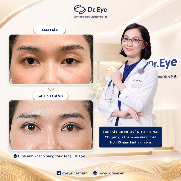 BS.CKII Nguyễn Thị Ly Na tại TPHCM BS.CKII Nguyễn Thị Ly Na tại TPHCM