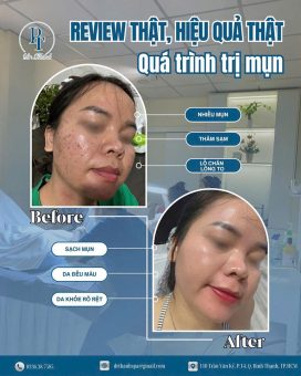 PT Beauty Dr Thanh chăm sóc da ở Gò Vấp uy tín