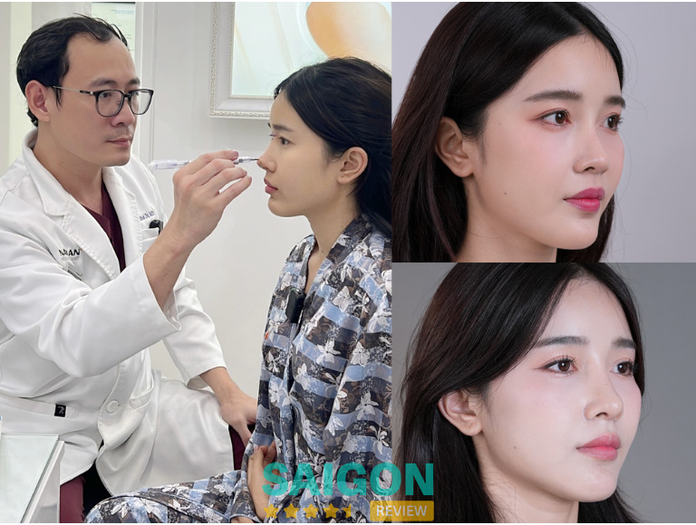 Chuyên gia nâng mũi sụn sườn được nhiều khách hàng tin chọn