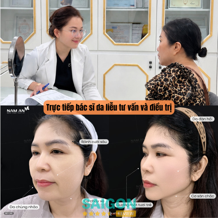 Bác sĩ tư vấn, thực hiện và thăm khám xuyên suốt quá trình căng chỉ chuẩn Bộ y tế