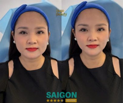 Bài viết đánh giá về Hugo Beauty: 38/14A Nguyễn Văn Trỗi, P. Cầu Kiệu, TPHCM